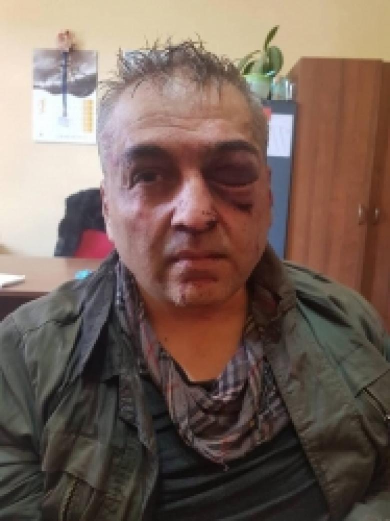 ДОПОЛНЕНО: разбойное нападение на филиал банка HSBC (ВИДЕО) ДОПОЛНЕНО: разбойное нападение на филиал банка HSBC (ВИДЕО)