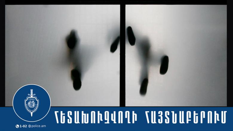 31-ամյա երիտասարդը հետախուզվում էր ծանր մարմնական վնասվածք պատճառելու մեղադրանքով 31-ամյա երիտասարդը հետախուզվում էր ծանր մարմնական վնասվածք պատճառելու մեղադրանքով