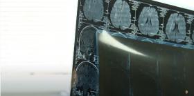 Ուսանողի առողջությանը պատճառվել էր ծանր վնաս. Կենտրոնականի և Արաբկիրի ոստիկանների բացահայտումը Ուսանողի առողջությանը պատճառվել էր ծանր վնաս. Կենտրոնականի և Արաբկիրի ոստիկանների բացահայտումը