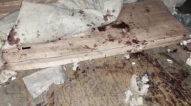 Տաշիրում ծեծի ենթարկված տղամարդը Երևանում մահացել է. մեկ անձ կալանավորվել է Տաշիրում ծեծի ենթարկված տղամարդը Երևանում մահացել է. մեկ անձ կալանավորվել է