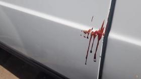 Արտաշատի գիշերային ակումբներից մեկում ծագած վեճն ավարտվել է դանակահարությամբ Արտաշատի գիշերային ակումբներից մեկում ծագած վեճն ավարտվել է դանակահարությամբ