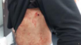 21-ամյա երիտասարդների անձնական վեճն ավարտվեց դանակահարությամբ 21-ամյա երիտասարդների անձնական վեճն ավարտվեց դանակահարությամբ