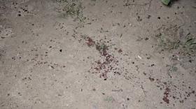 Հրազենային վնասվածք էր պատճառել համագյուղացուն. հանցագործությունը բացահայտվեց թարմ հետքերով Հրազենային վնասվածք էր պատճառել համագյուղացուն. հանցագործությունը բացահայտվեց թարմ հետքերով